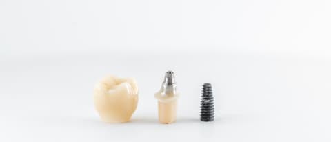 implant teeth